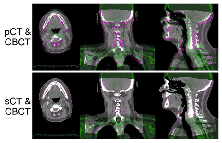 ESTRO2025 abstract